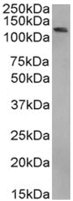 BRD4 Antibody (RAB-C131) - Chimeric - Azide and BSA Free, Novus Biologicals:Antibodies:Primary