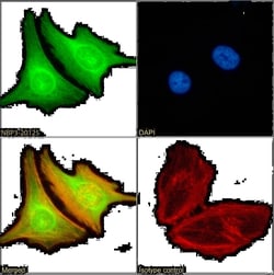 BRD4 Antibody (RAB-C131) - Chimeric - Azide and BSA Free, Novus Biologicals:Antibodies:Primary