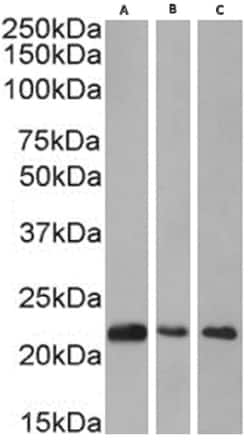 CBX1 Antibody (RAB-C145) - Chimeric - Azide and BSA Free, Novus Biologicals