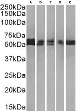 PRMT3 Antibody (RAB-C372) - Chimeric - Azide and BSA Free, Novus Biologicals
