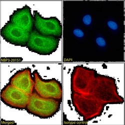 SUV420H2 Antibody (RAB-C409) - Chimeric - Azide and BSA Free, Novus Biologicals:Antibodies:Primary