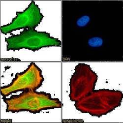 FoxP2 Antibody (RAB-S249) - Chimeric - Azide and BSA Free, Novus Biologicals:Antibodies:Primary