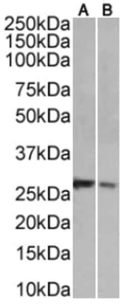 NKG2D/CD314 Antibody (6E5A7) - Chimeric - Azide and BSA Free, Novus Biologicals:Antibodies:Primary