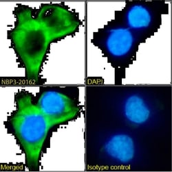 Tau Oligomeric Complex Antibody (TOC1) - Chimeric - Azide and BSA Free, Novus Biologicals 0.2 mg | Buy Online | Novus Biologicals | Fisher Scientific