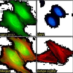 MAGEA3 Antibody (21B4) - Chimeric - Azide and BSA Free, Novus Biologicals