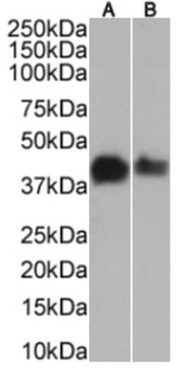 MAGEA3 Antibody (21B4) - Chimeric - Azide and BSA Free, Novus Biologicals