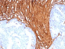 Periostin/OSF-2 Antibody (POSTN/8523R) - Azide and BSA Free, Novus Biologicals