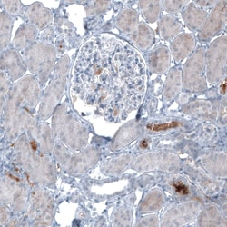 alpha-Fetoprotein/AFP Antibody (CL9772), Novus Biologicals:Antibodies:Primary