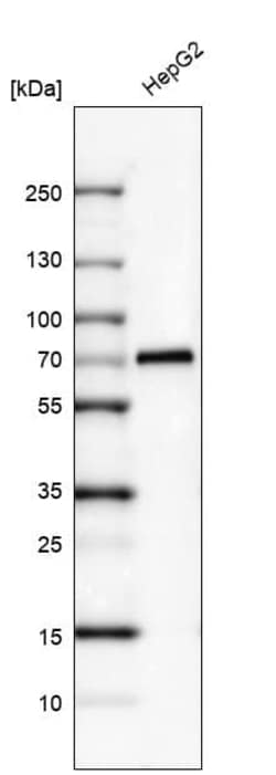 alpha-Fetoprotein/AFP Antibody (CL9772), Novus Biologicals:Antibodies:Primary