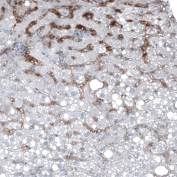 alpha-Fetoprotein/AFP Antibody (CL9772), Novus Biologicals:Antibodies:Primary