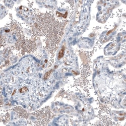 alpha-Fetoprotein/AFP Antibody (CL9772), Novus Biologicals:Antibodies:Primary