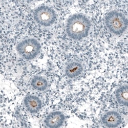 CD133 Antibody (CL7971), Novus Biologicals:Antibodies:Primary Antibodies
