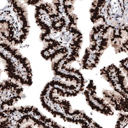 Progesterone R B/NR3C3 Antibody (CL8721), Novus Biologicals:Antibodies:Primary