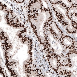 Progesterone R B/NR3C3 Antibody (CL8721), Novus Biologicals:Antibodies:Primary