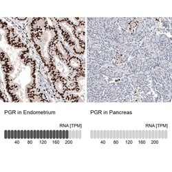 Progesterone R B/NR3C3 Antibody (CL8721), Novus Biologicals:Antibodies:Primary