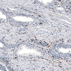 Progesterone R B/NR3C3 Antibody (CL8721), Novus Biologicals:Antibodies:Primary