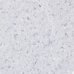 Progesterone R B/NR3C3 Antibody (CL8721), Novus Biologicals:Antibodies:Primary