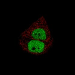 Progesterone R B/NR3C3 Antibody (CL8721), Novus Biologicals:Antibodies:Primary