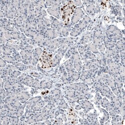 Progesterone R B/NR3C3 Antibody (CL8721), Novus Biologicals:Antibodies:Primary