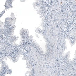 MUC2 Antibody (CL9148), Novus Biologicals 100 &mu;g; Unconjugated:Antibodies,