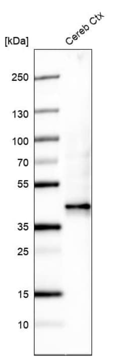 beta-1,3-Glucuronyltransferase 1/B3GAT1 Antibody (CL9500), Novus Biologicals