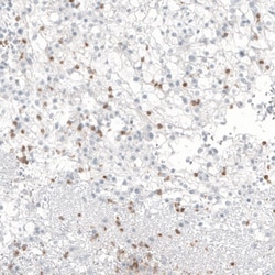 beta-1,3-Glucuronyltransferase 1/B3GAT1 Antibody (CL9500), Novus Biologicals