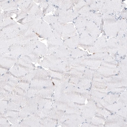 beta-1,3-Glucuronyltransferase 1/B3GAT1 Antibody (CL9500), Novus Biologicals