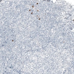 beta-1,3-Glucuronyltransferase 1/B3GAT1 Antibody (CL9500), Novus Biologicals