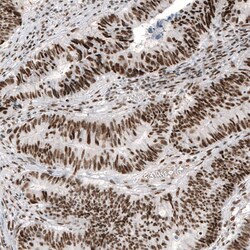 c-jun Antibody (CL9662), Novus Biologicals:Antibodies:Primary Antibodies