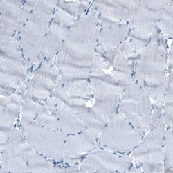 alpha-Fetoprotein/AFP Antibody (CL9766), Novus Biologicals:Antibodies:Primary