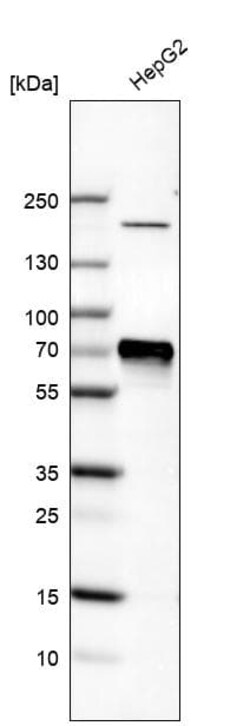 alpha-Fetoprotein/AFP Antibody (CL9766), Novus Biologicals:Antibodies:Primary