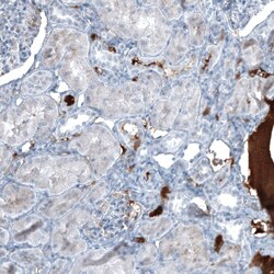 alpha-Fetoprotein/AFP Antibody (CL9766), Novus Biologicals:Antibodies:Primary
