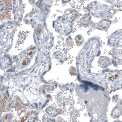alpha-Fetoprotein/AFP Antibody (CL9766), Novus Biologicals:Antibodies:Primary