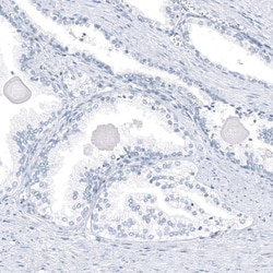 AGER Antibody (CL10591), Novus Biologicals 100 &mu;g; Unconjugated:Antibodies,