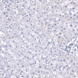ANO2 Antibody (CL10631), Novus Biologicals 25 &mu;g; Unconjugated:Antibodies,