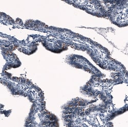 ANO2 Antibody (CL10631), Novus Biologicals 25 &mu;g; Unconjugated:Antibodies,