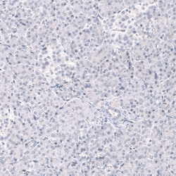 ANO2 Antibody (CL10631), Novus Biologicals 25 &mu;g; Unconjugated:Antibodies,