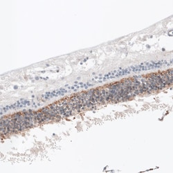 ANO2 Antibody (CL10631), Novus Biologicals 25 &mu;g; Unconjugated:Antibodies,