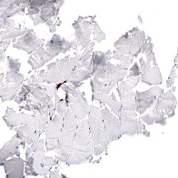 CD163 Antibody (CL10658), Novus Biologicals 25 &mu;L; Unlabeled:Antikörper