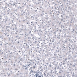 AlphaB Crystallin/CRYAB Antibody (CL10758), Novus Biologicals 25 &mu;L;