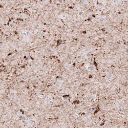 AlphaB Crystallin/CRYAB Antibody (CL10758), Novus Biologicals 25 &mu;L;