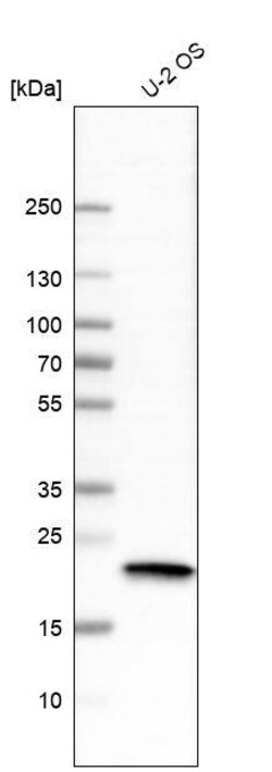 AlphaB Crystallin/CRYAB Antibody (CL10758), Novus Biologicals 25 &mu;L;
