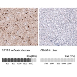AlphaB Crystallin/CRYAB Antibody (CL10758), Novus Biologicals 25 &mu;L;