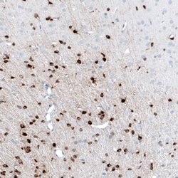 AlphaB Crystallin/CRYAB Antibody (CL10758), Novus Biologicals 25 &mu;L;