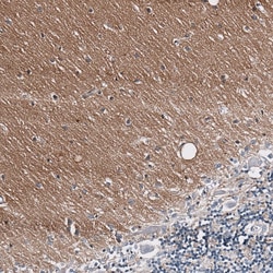 GAP-43 Antibody (CL10884), Novus Biologicals:Antibodies:Primary Antibodies