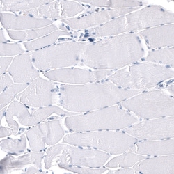GAP-43 Antibody (CL10884), Novus Biologicals:Antibodies:Primary Antibodies