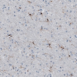 AIF-1/Iba1 Antibody (CL10936), Novus Biologicals:Anticuerpos:Anticuerpos