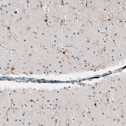 AIF-1/Iba1 Antibody (CL10936), Novus Biologicals:Anticuerpos:Anticuerpos