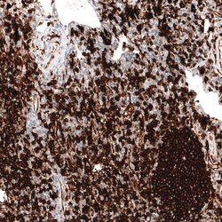 HLA DR/DP Antibody (CL10962), Novus Biologicals 25 &mu;g; Unconjugated:Antibodies,