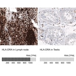 Thumbnail_HLA DR/DP Antibody (CL10962), Novus Biologicals 25 &mu;g; Unconjugated:Antibodies,